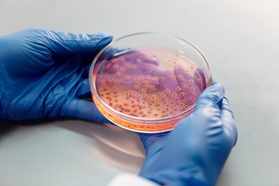Cyclospora Case Counts Will Keep Climbing for Weeks After the Illnesses Themselves Stop