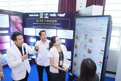 New AI tool improves psoriasis screening