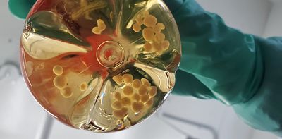 Recurring risk: Like Zika, Oropouche virus can also affect the brains of unborn babies
