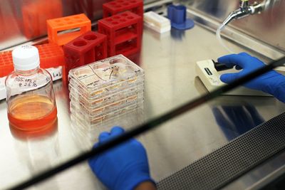 A Protein Known for Guarding Chromosome Ends Also Keeps Muscle Stem Cells Ready to Repair Injury