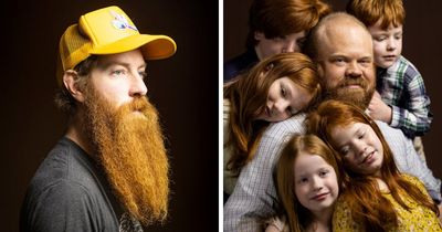 This Photographer Captures The Diversity Of Natural Red Hair In ‘The Little Book Of Gingers’ (30 New Pics)