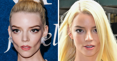 After Anya Taylor-Joy Seemingly Went Back On Her Buccal Fat Removal, Expert Weighs In On Reversal Procedure