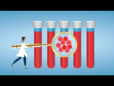 Rajasthan govt steps up efforts to tackle sickle cell anaemia in tribal areas; over 37 lakh screened