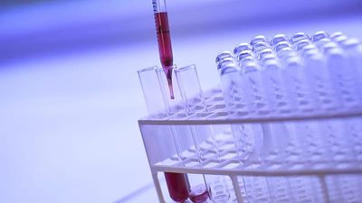 Basque Country halves colon cancer deaths with screening programme