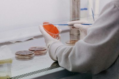 Salmonella Rates Look Flat in New CDC Data, but Faster Lab Tests Changed What Those Numbers Measure