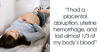54 Moms Open Up About The Brutal Things Their Bodies Endured To Give Birth