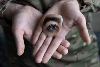 Blinded by War: documenting the aftermath of injury in Ukraine – photo essay