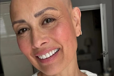 7 Photos of Melanie Sykes That Trace Her Alopecia Journey After Hair Loss Diagnosis