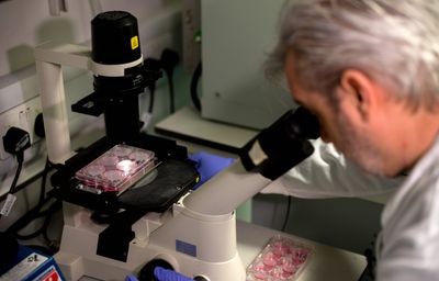 Michigan Says Cyclospora Cases Now Being Logged Are Mostly Old Infections, Not New Ones