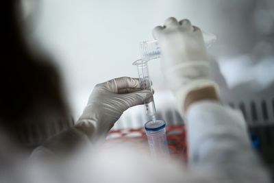 Experimental Pancreatic Cancer Vaccine Triggered Targeted Immune Responses in 18 of 20 High-Risk Patients