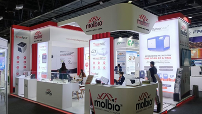Molbio Diagnostics collects Rs 281 cr from anchor investors ahead of IPO