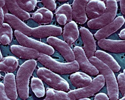 Louisiana warns beachgoers amid surge in flesh-eating bacteria infections