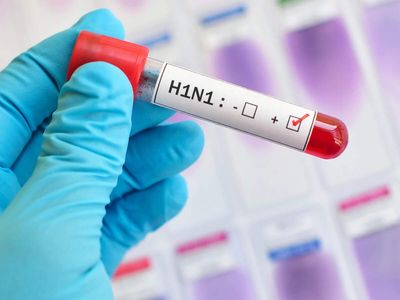 H1N1 cases in Delhi : What are the symptoms, prevention tips as cases jump 6-fold from last year
