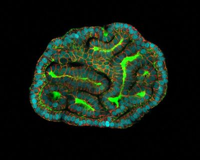 ‘A mouse can’t tell us what works’: UK scientists to grow miniature human organs for drug testing