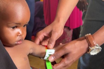 Somalia battles child hunger as MSF says effort hit by funding cuts