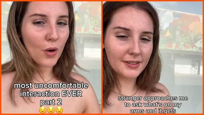 British woman tries to answer a stranger’s question about her skin. Then he becomes increasingly invasive: ‘definitely took a turn’