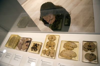 Airless Graves Can Preserve Human Brains for Thousands of Years, and Scientists Finally Know Why