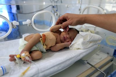 A Heart Defect in 3 of Every 10,000 Babies May Start in DNA That Does Not Code for Anything
