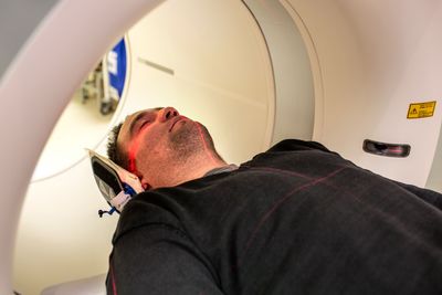 Former Smokers Stay Eligible for Lung Cancer Screening for 15 Years After Quitting, and Most Never Get Scanned