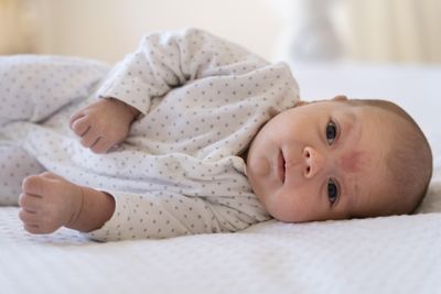 A Trial of Nearly 4,000 Babies Found No Difference in Eczema or Bronchiolitis Hospitalization Between Acetaminophen and Ibuprofen