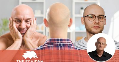 Finally, bald men like me have their day in the sun