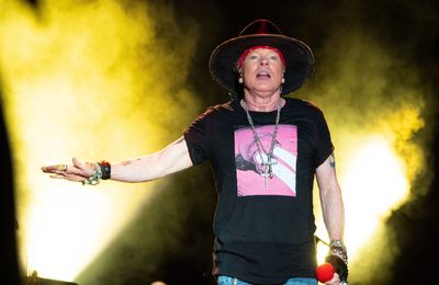 Axl Rose undergoes jaw surgery