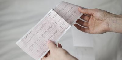 What is sudden adult death syndrome?