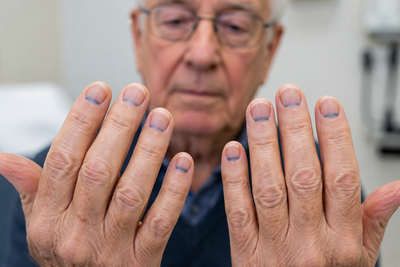 Blue Crescents Under His Fingernails Had Been There 50 Years, and They Pointed Straight to a Bottle in His Bathroom Cabinet