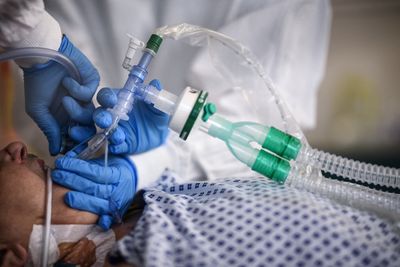 Ventilator Breathing Circuits Receive the FDA's Most Serious Recall Class After Four Reported Serious Patient Injuries