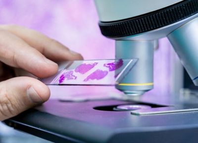 FDA Eases Approval Path for Certain Cancer Companion Diagnostic Tests