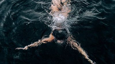 Florida woman goes swimming. Then she wakes up missing ‘a lot’ of her leg. Here’s her warning: ‘You can get it’