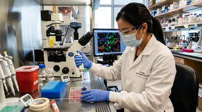 Your Skin Keeps a Chemical Alarm That Tells the Rest of Your Body When to Make Antibodies