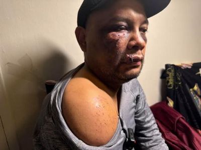 Man suffered brain injury and severe bruising after ICE arrest in Virginia, records show