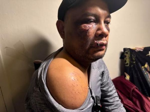 Man suffered brain injury and severe bruising after ICE arrest in Virginia, records show