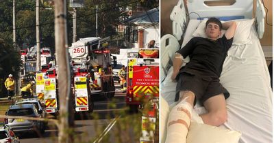 His heroic act saved a life, but now this teen faces a long road to recovery