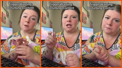 Woman used to seal mail with her tongue. After a terrifying discovery, she vows never to lick an envelope again: ‘use some water’