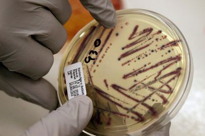 Alfalfa sprouts recalled after being linked to multi-state Salmonella and E. Coli outbreak