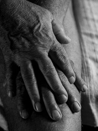 Arthritis Pain? These Foods May Help — and Others Could Make Things Worse