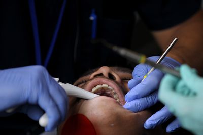 Pancreatic Cancer Patients with 21 or More Natural Teeth Lived Nearly Two Years Longer After Surgery