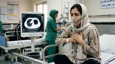 Her Oxygen Hit 75% and Her Mind Slipped, and a Six Inch Tapeworm Cyst Was Filling One Lung