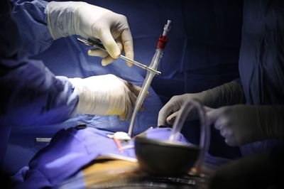 His Blood Pressure Hit 210 Over 140, and the Cause Was a Hormone-Making Tumor Inside His Heart