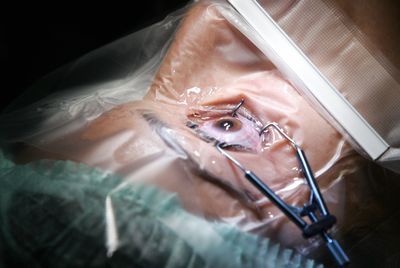 The Eye Injuries Doctors Miss Most Often Are the Ones Where Patients Can Still See Perfectly