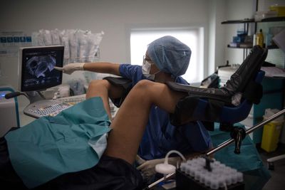 A Band Placed to Prevent Preterm Birth Turned Up Seven Years Later Inside the Patient's Rectum