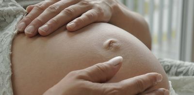 Twins can have different parents. How is that possible? A fertility expert explains