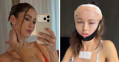 How Young Is Too Young To Get A Korean Facelift? Netizens Criticize Influencer’s Decision After Recovery Posts