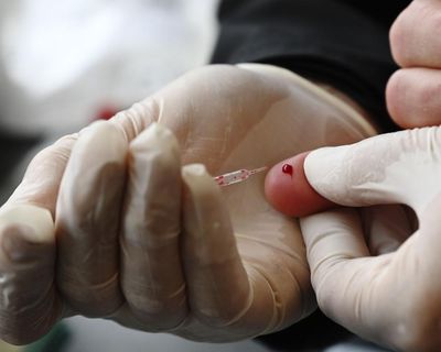 Free cholesterol tests on the NHS are great – but here’s the five-point health MOT I’d really like to see