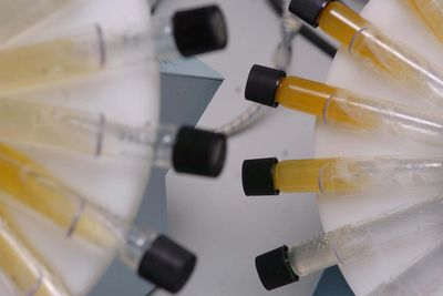 The non-invasive, at-home test that could detect cancer