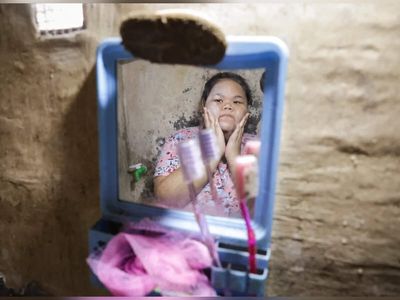From hunger to obesity: Developing world faces growing threat to child health