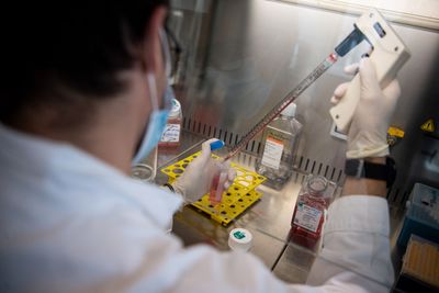 A Lung Cell Textbooks Call Short Lived Turned Out to Survive Four Months, and It May Fix Nasal Flu Shots