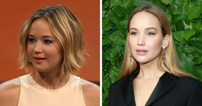 Jennifer Lawrence’s Plastic Surgery Confession Draws Backlash As Photoshoot Sparks Fresh Scrutiny